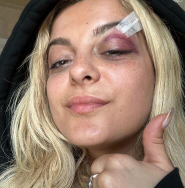 Bebe Rexha fue golpeada por un celular durante concierto