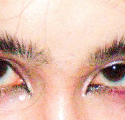 “Cállate la boca”, el original single de Blnko