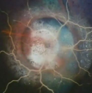 Nuevo video de Crosses