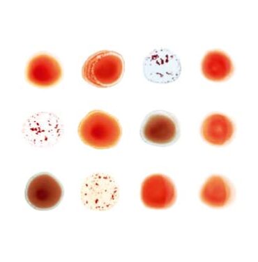 Listo el álbum tributo a Peter Gabriel